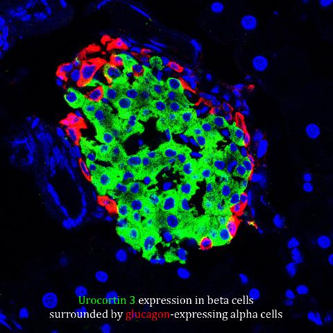 Crosstalk Between Cells in Diabetes