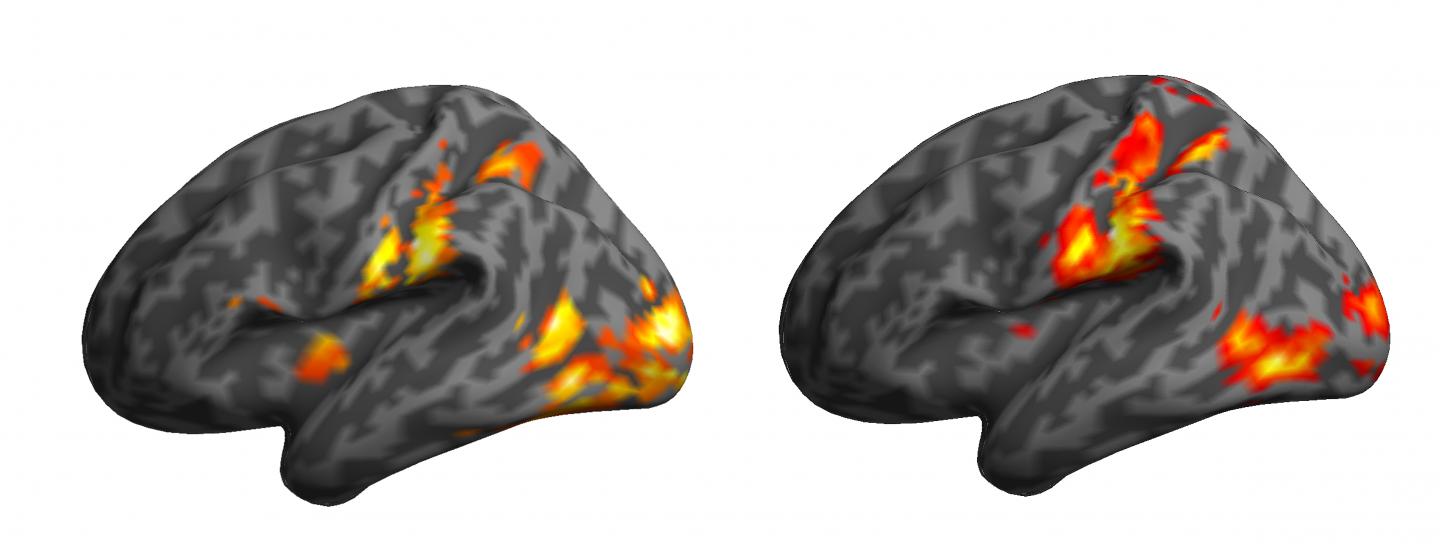 Brain Responses to Watching Motor Actions