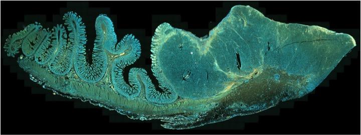 Immunohistochemical analysis