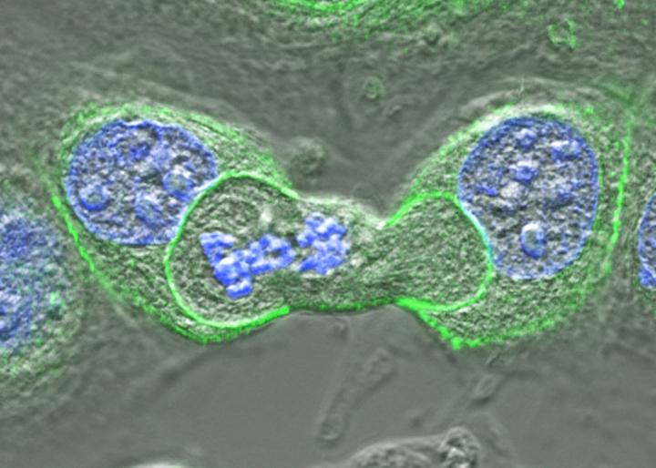 A Dividing Cell Being Cannibalized by Two Other Cells