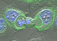 A Dividing Cell Being Cannibalized by Two Other Cells
