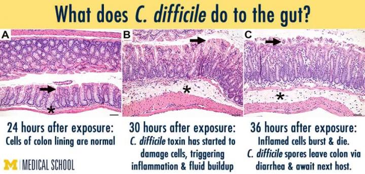 Effect of <i>C. difficile</i> on Gut Lining Cells