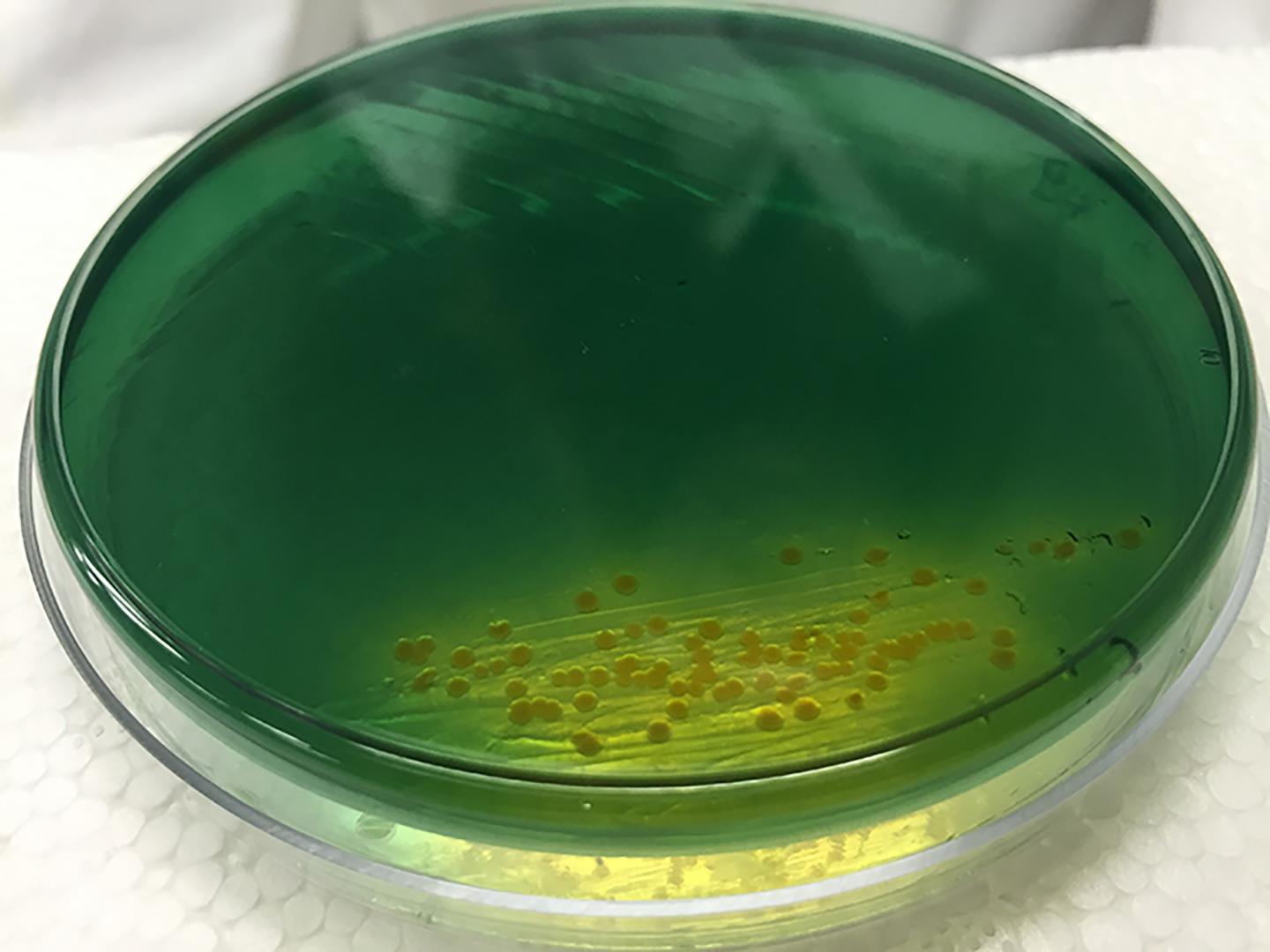 Cholera Colonies on Agar 2