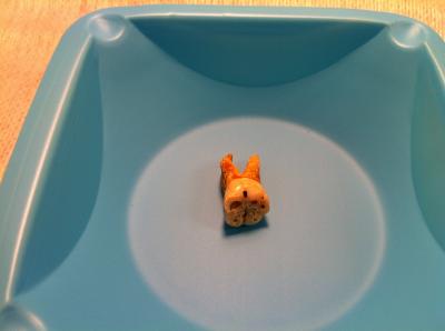 Close-up of Ancient Tooth