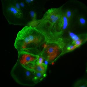 Placenta cells infected with the SARS-CoV-2 virus