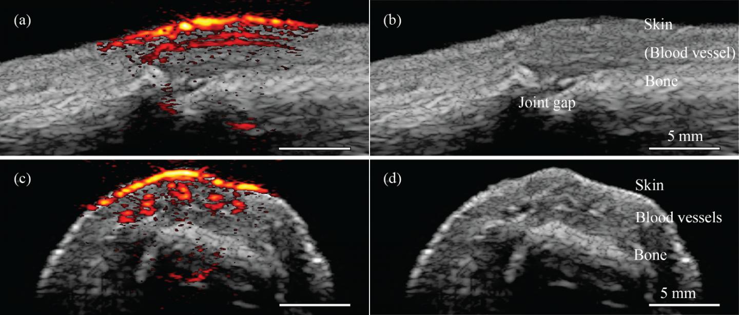 Photoacoustic Images