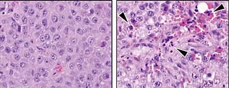 Melanoma Cells, Kun-liang Guan, et al UC San Diego School of Medicine