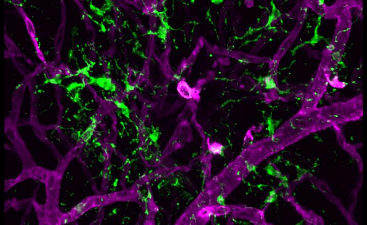 Retinal Microglia