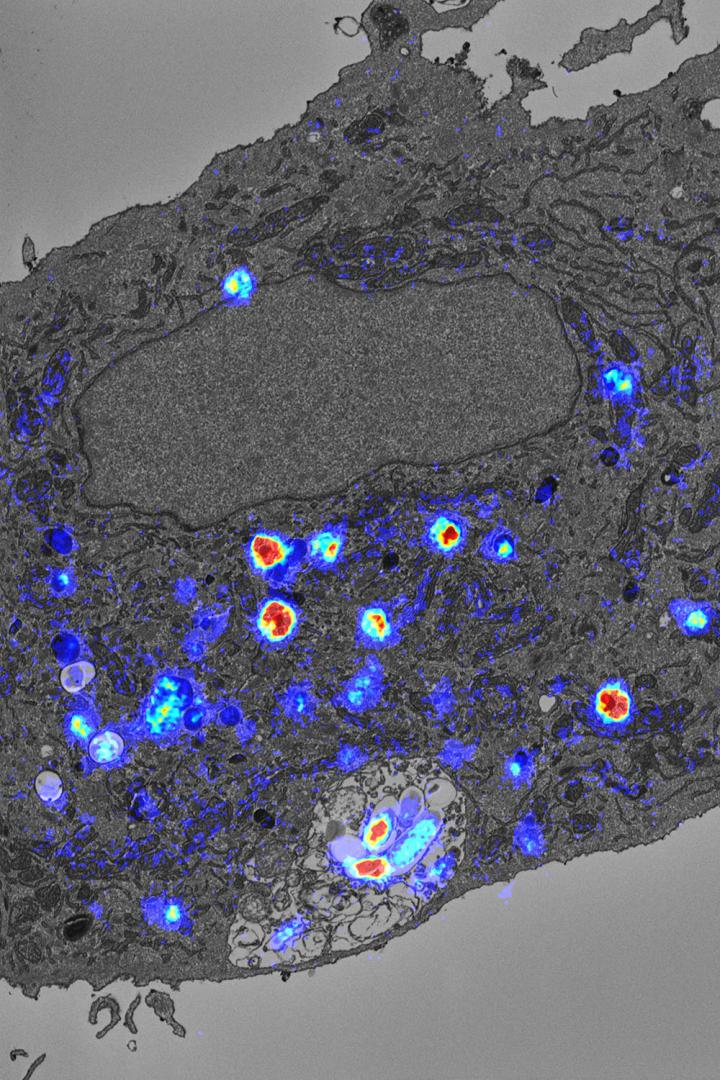 TB Antibiotic Visualisation 2