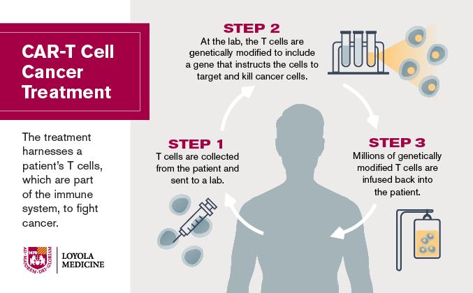 CAR-T Cell Cancer Therapy [IMAGE] | EurekAlert! Science News Releases