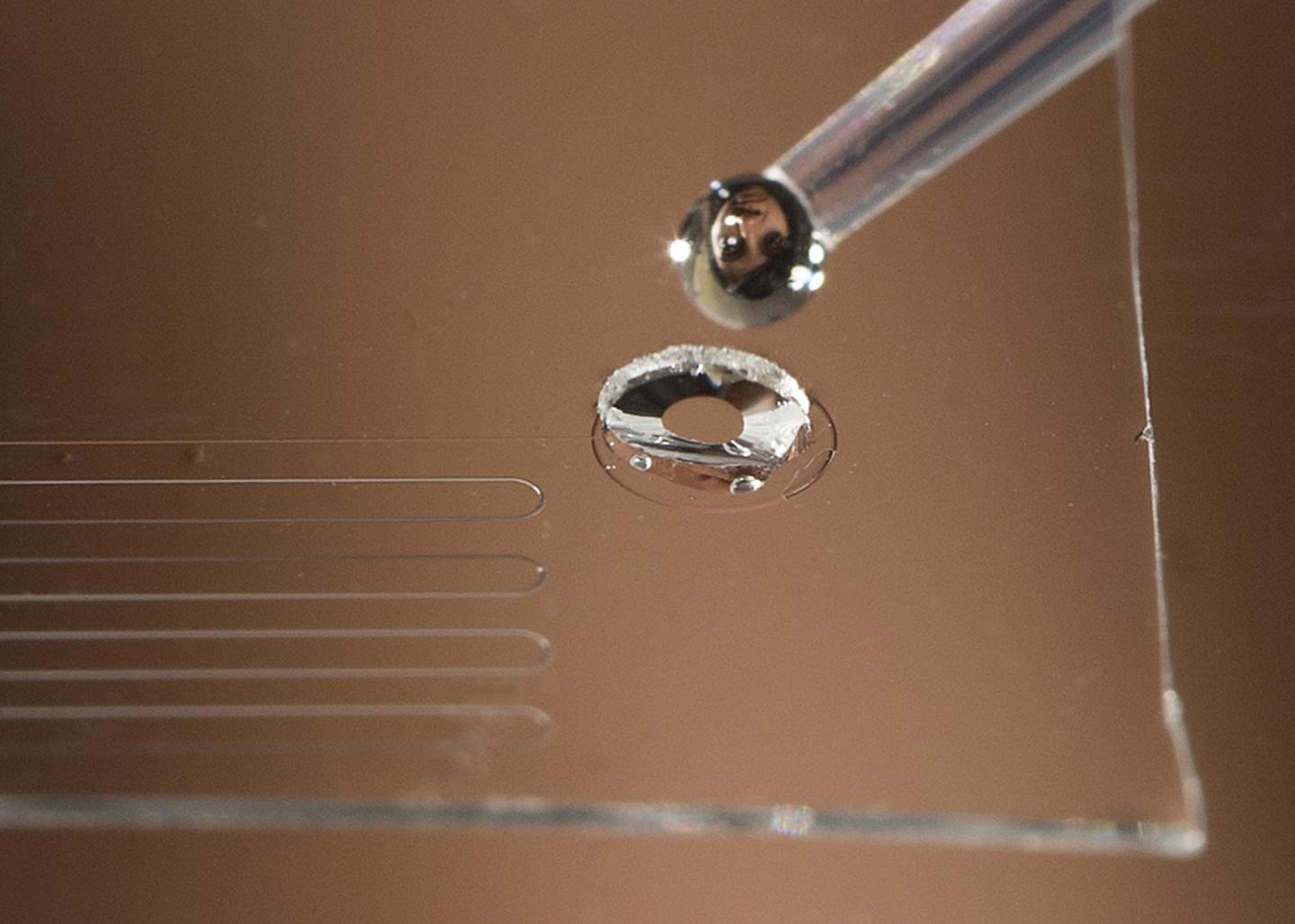 Device Detects Prostate Cancer in Urine