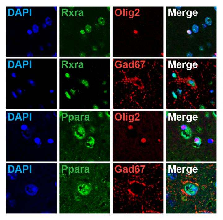 Gene-Expression Analyses in the AA(+)/DHA(+) and AA(?)/DHA(?) groups
