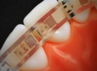 Flexible Batteries a Highlight for Smart Dental Aids 2
