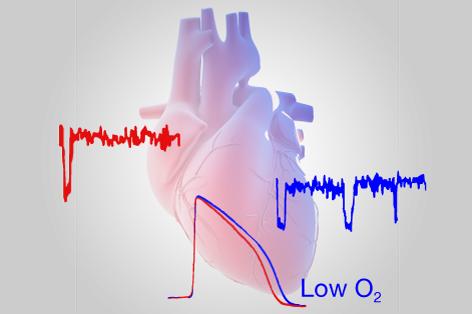 Rapid SUMOylation of Cell Surface Cardiac Sodium Channels Causes Late Sodium Current in Response