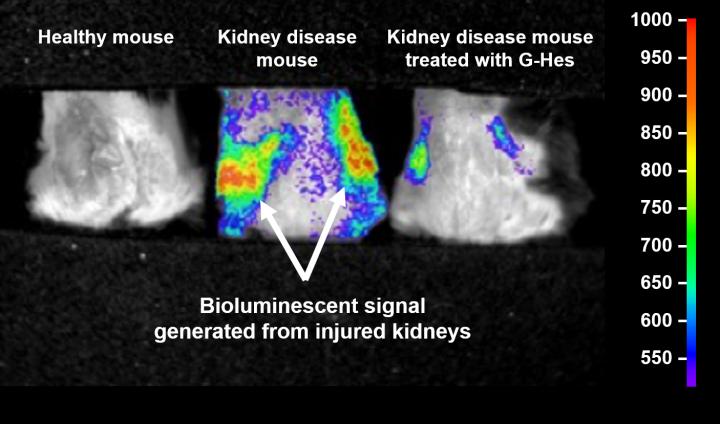 Visualization of Kidney Disease and Therapy by the Citrus Fruit-Derived Compound Treatment