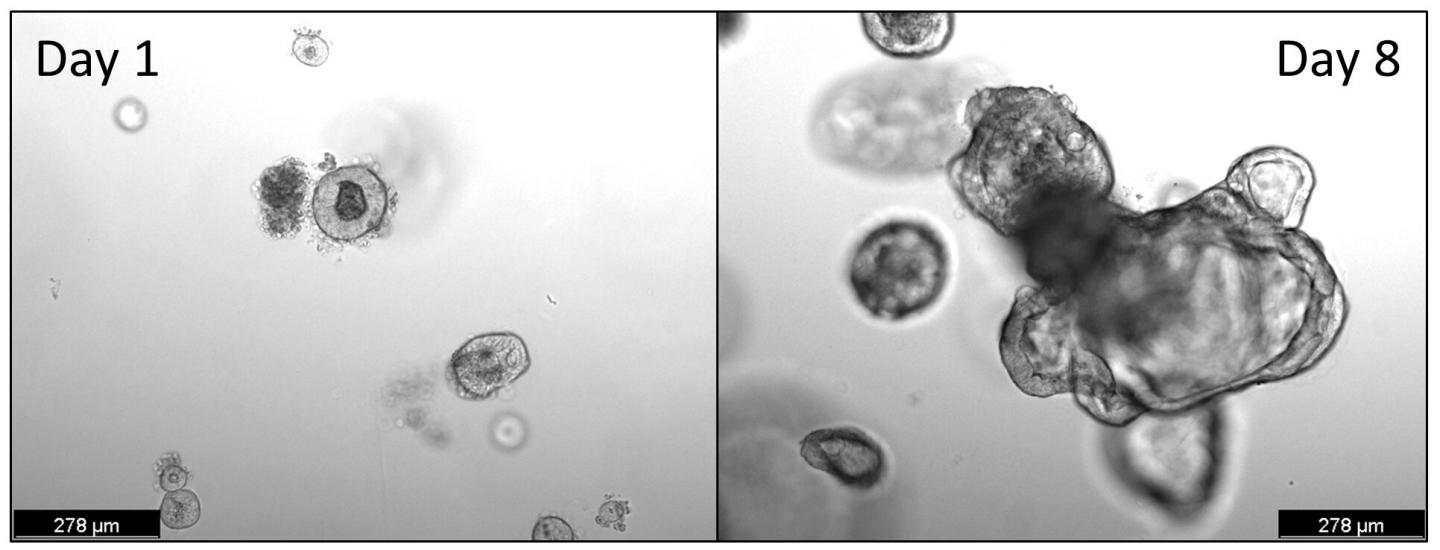 Organoid Growth