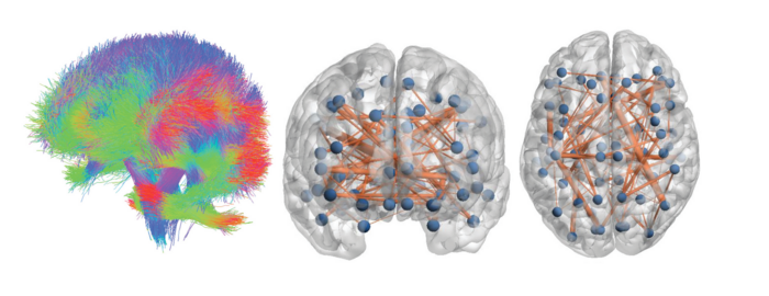 Spatial structure tractography and temporal structure showing connection between edges