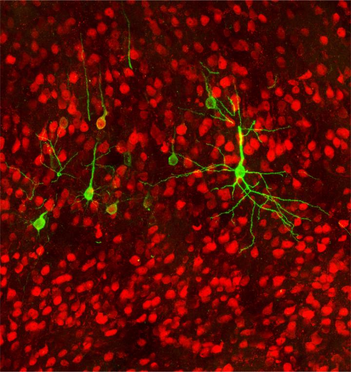 Brain to Stomach Connection