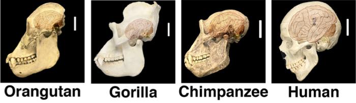 Brain Comparison