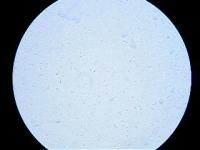 <i>Campylobacter</i> under a Microscope