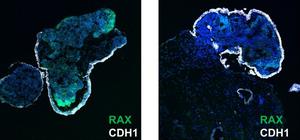 IImages of organoids without genetic modification stained for RAX