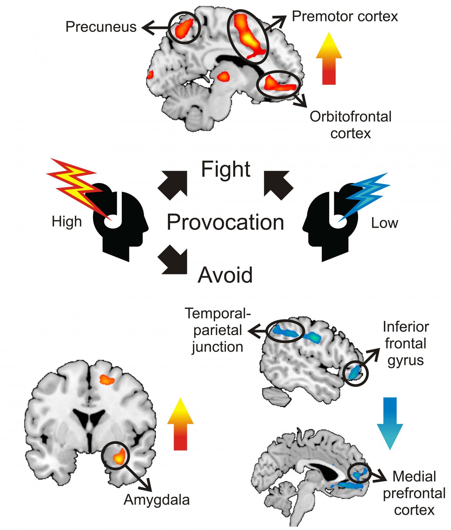The Brain's Fight and Flight Responses to Social Threat
