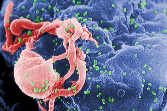Image of HIV