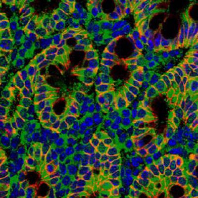 A Glimpse through the Laser Microscope