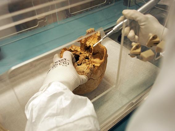 Sampling Petrous Bone