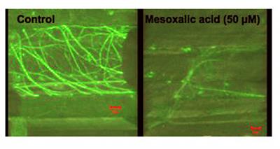 Micrographs Showing Effects of Phragmites Biotoxin
