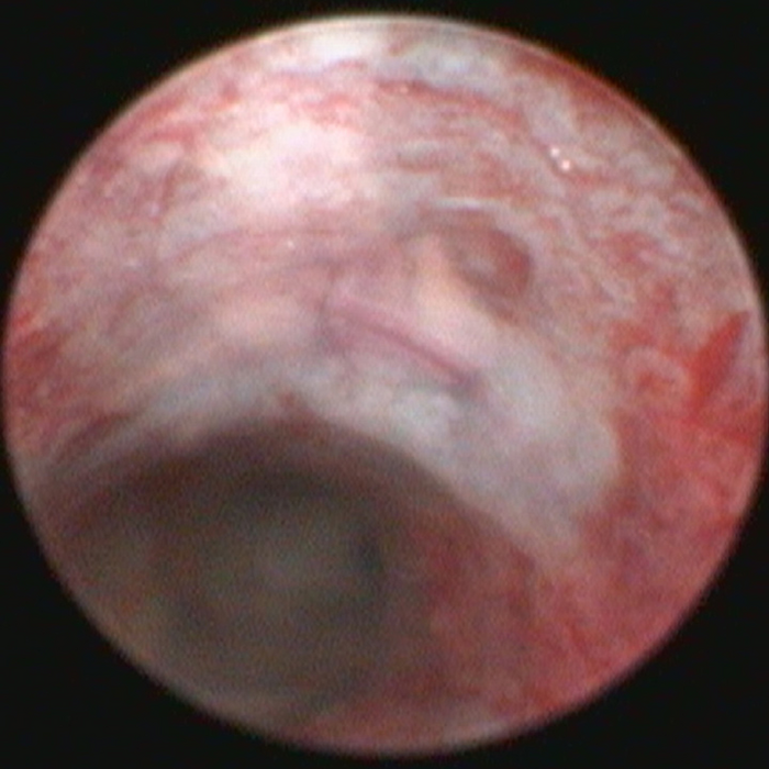 UTSW researchers discover new drug target for inflammatory bowel disease