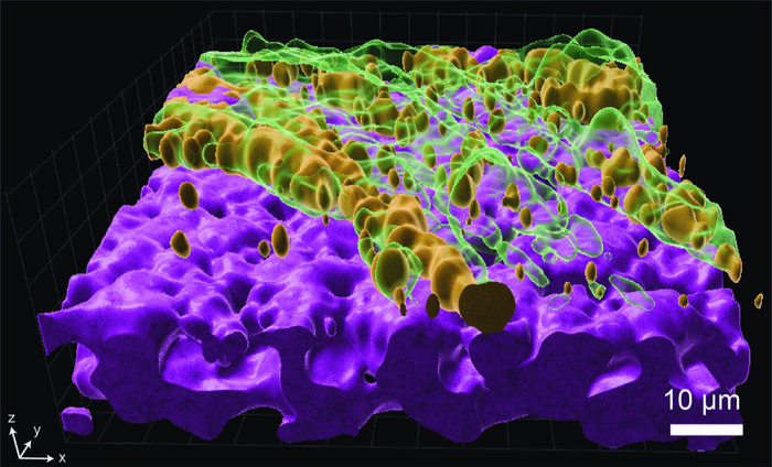 Pseudomonas aeruginosa cells (orange) growing on the mucus layer (green) of the airway mucosa.