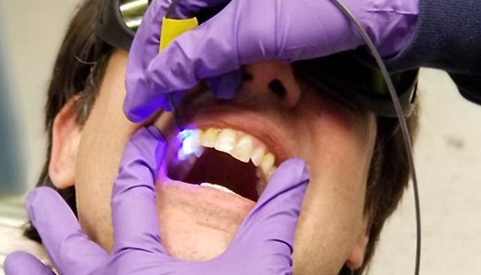 Dentistry procedure
