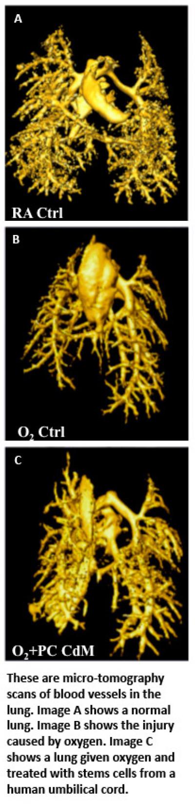 Comparison of Blood Vessels in the Lung