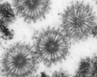 The virus-like particles found in bacteria inside Paralicornia sinuosa