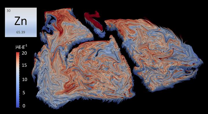 Elemental Bio-Images of Mouse Lungs during <i>Streptococcus pneumoniae</i> Infection