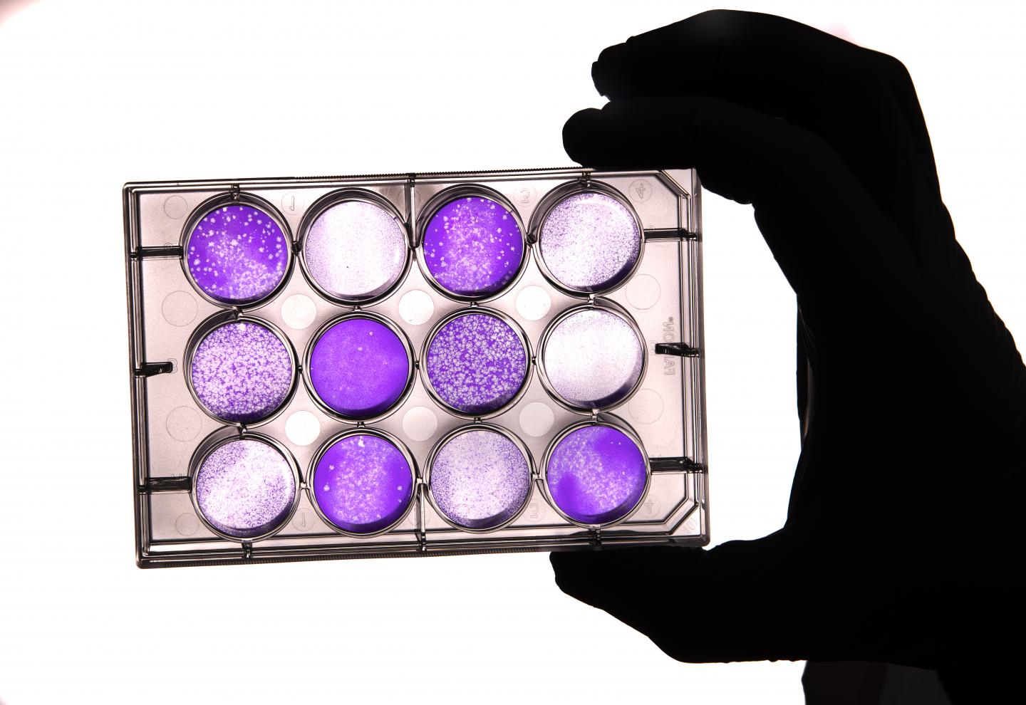 Vaccine Storage -- Culture Close-up