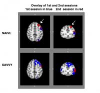 Brain Image Overlay UCLA Internet Study