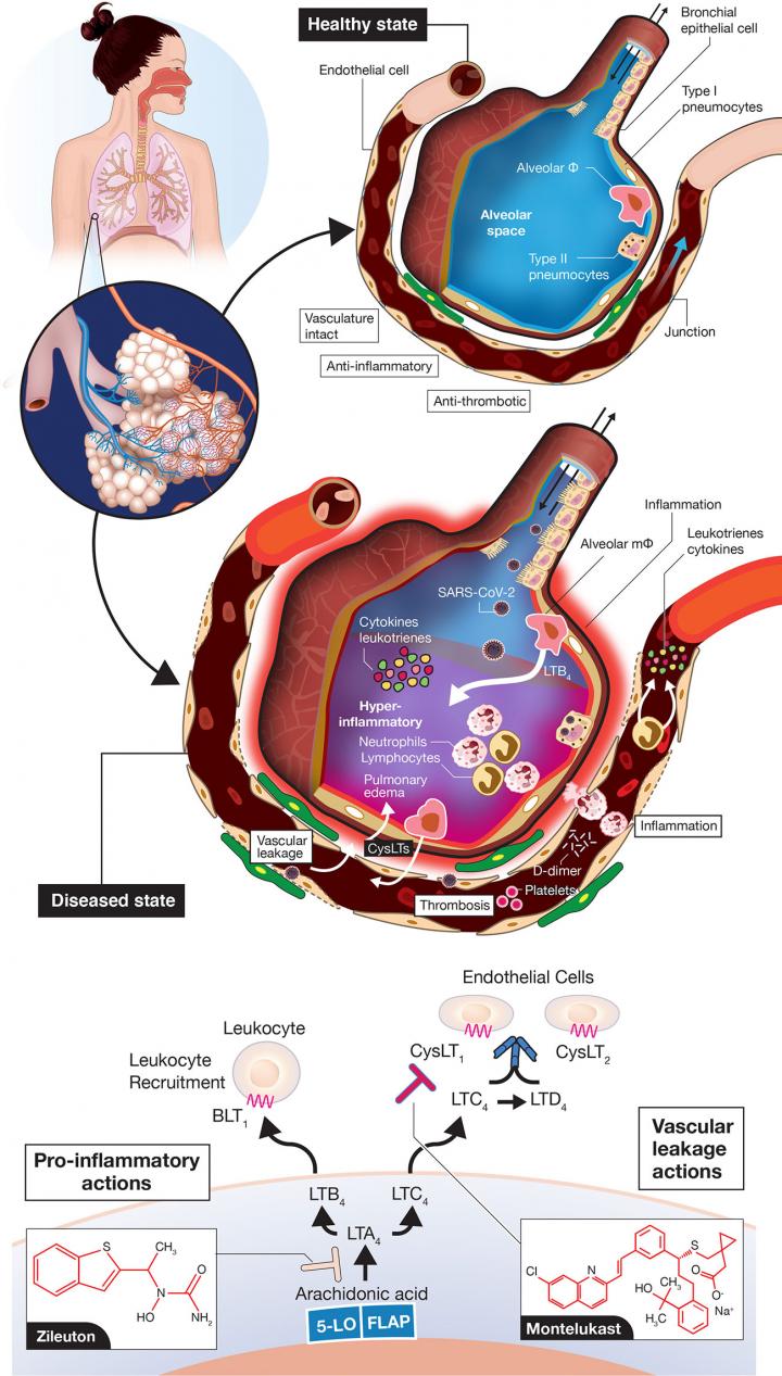 Vascular Leakage, Inflammation-Provoking, and Thrombotic Events in Coronavirus Disease 2019