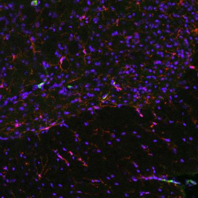 Immune Cells (2 of 2)