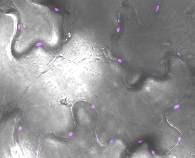Plasmodesmal Channels