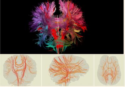 Two-dimensional Brain