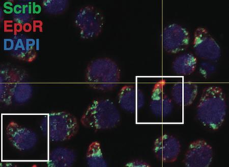 Anemia Discovery Offers New Targets to Treat Fatigue that Affects Millions