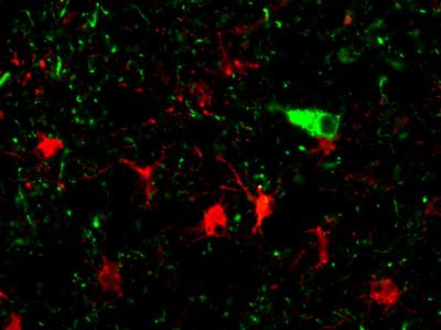 Dementia in the Brain