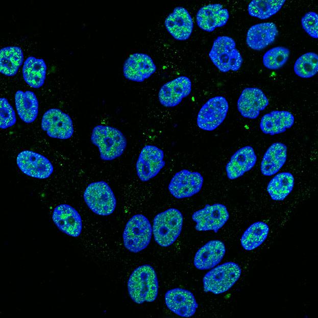 Cultured Human Breast Cells (Blue) after Irradiation Exposure, with Sites of DNA Damage (Green)
