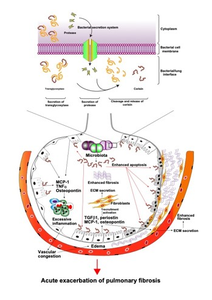 Schematic of corisin's role in lung fibrosis