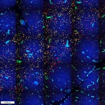 Section through a Developing Human Thymus, Zooming down into Cellular Detail