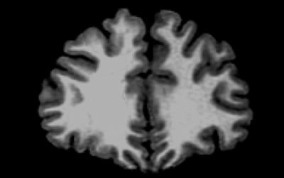 MRI Scan of a 24-year-old Male Human Brain