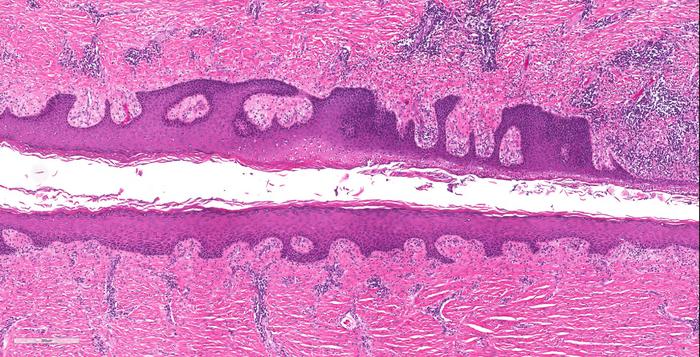 Histology of HS