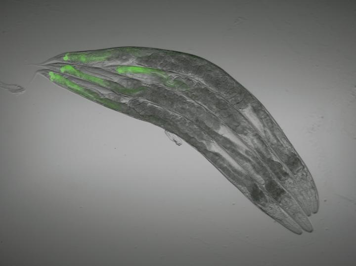Guts of <I>C. elegans</I>